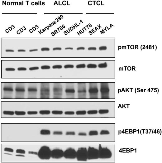 Figure 1. Activation of mTOR signaling in TCL cell lines (n = 6) and normal T cells (n = 3). Western blotting was performed on 6 TCL cell lines of ALCL (Karpas 299, SUDHL1, and SR786) and CTCL (HuT 78, SeAx, and MyLa) subtypes, along with CD3+ T cells using phosphorylation site-specific antibodies for mTOR, AKT, and 4EBP1.