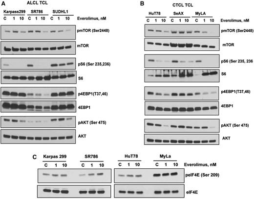 Figure 4. Effects of everolimus on mTOR signaling in TCL cell lines. (A-B) ALCL and CTCL cell lines were treated with 1 and 10 nM of everolimus overnight. Whole cell lysate were then subjected to western blotting with phospho-specific antibodies to mTOR, S6, 4EBP1, and AKT as indicated. (C) Karpas 299, SR786, HuT 78, and MyLa TCL cell lines were treated with everolimus overnight and western blotting was performed using phosho-eIF4E antibody.