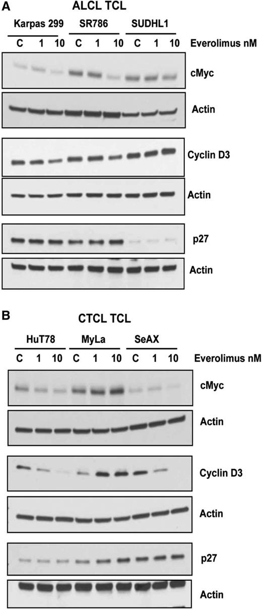 Figure 5. Effects of everolimus on cell cycle regulatory proteins in TCL. (A-B) ALCL (A) and CTCL (B) TCL cell lines were treated with everolimus for 24 hours and then subjected to western blot analysis for cell cycle regulatory proteins, such as c-Myc, cyclin D1, and P27.