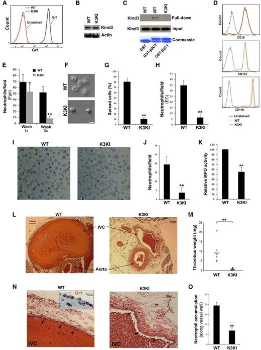Figure 1. Adhesion and recruitment of K3KI neutrophils are suppressed in vitro and in vivo. (A) BM neutrophils isolated from WT and K3KI mice were stained with an anti-Gr1 antibody and analyzed by flow cytometry. (B) Western blotting to measure kindlin-3 expression in BM neutrophils. (C) Pull-down assay to measure interaction of glutathione S-transferase (GST)-β2CT protein with kindlin-3 in neutrophil lysates. GST alone was used as a control. Bound kindlin-3 protein in the precipitates was evaluated by western blotting; GST and GST-β2CT proteins were evaluated by Coomassie blue staining. (D) Surface expression of the β2-integrin subunits on BM neutrophils of WT and K3KI mice were measured by flow cytometry. (E-G) BM neutrophils were incubated with immobilized Fgn for 30 minutes in the presence of PMA (20 nM). The adherent cells were fixed and counted by microscopy (E); the representative images were exhibited (F); and percentage of spread cells were analyzed (G). Scale bar = 10 µm. (H) PMA-stimulated BM neutrophils were allowed to adhere to tumor necrosis factor-α primed EC monolayer, and the adherent neutrophils were fixed, stained with an fluorescein isothiocyanate-conjugated anti-Gr1 antibody and quantified under a fluorescence microscope. (I) Representative histologic images (×20 objective) of liver tissues isolated from the endotoxemic mice with IHC staining of Gr1. (J) Gr1-positive neutrophils recruited in the livers of endotoxemic mice. (K) MPO was extracted from the fresh liver tissues of endotoxemic mice and MPO activity was measured as described before.22 (L) Representative histologic images (×4 objective) of the ligated mouse IVC tissues with staining of hematoxylin and eosin. (M) Thrombi formed in the ligated IVC tissues were isolated and quantified by weighing. (N) Neutrophil recruitment was visualized in histologic sections (×20 objective) of the ligated IVC tissues with staining of hematoxylin and eosin. IHC staining for Gr1 was shown in the insertion (×40 objective). (O) The accumulated neutrophils along the vessel walls (arrowhead) in the ligated IVC tissues were quantified. Data represent mean ± SEM of 3 or more independent experiments; *P < .05; **P < .01 (paired Student t test). EC, endothelial cell; Fgn, fibrinogen.