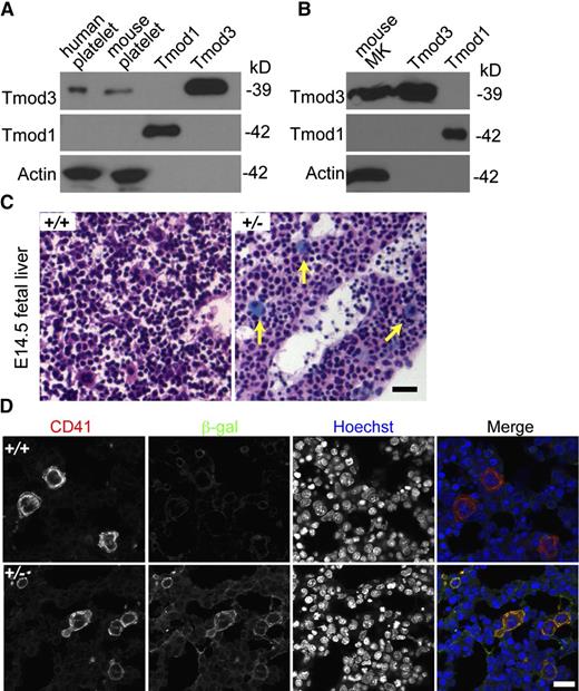 Figure 1. Tmod3 is expressed in platelets and MKs. (A) Western blotting of Tmod expression in human and mouse platelets. (B) Western blotting of Tmods in MKs cultured from mouse fetal liver (E13.5); 10 ng purified recombinant Tmod1 and Tmod3 proteins were used as controls (A-B). (C) LacZ staining of sections from Tmod3+/+ (left) and Tmod3+/− (right) E14.5 embryos. Embryos were dissected and stained with X-gal and H&E. Yellow arrows indicate large MKs with bright blue staining. Bar, 40 µm. Images were acquired with a ×20 objective (N.A. 0.5) using a Zeiss Axioskop microscope and a Zeiss AxioCam ICc3 color camera. (D) Immunofluorescence staining for β-galactosidase (green) and CD41 (red) in cryosections of Tmod3+/+ and Tmod3+/− E14.5 embryos. Bar, 20 µm. Images were acquired using a Zeiss LSM 780 confocal laser scanning fluorescence microscope with a ×60 oil-immersion objective (N.A. 1.4).