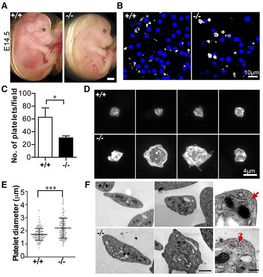 Figure 2. Tmod3−/− embryos show hemorrhages with abnormal platelets. (A) Representative images of whole Tmod3+/+ (left) and Tmod3−/− (right) embryos at E14.5. Bar, 1 mm. (B) Immunofluorescence staining for CD41 (gray) and Hoechst (blue) in cryosections of blood vessels of Tmod3+/+ (left) and Tmod3−/− (right) embryos, revealing circulating CD41+ platelets in situ. Bar, 10 µm. Images are single optical sections acquired using a Zeiss LSM 780 confocal laser scanning fluorescence microscope with a ×100 oil-immersion objective (N.A. 1.4), zoom 1. (C) Relative numbers of platelets in peripheral blood of Tmod3+/+ and Tmod3−/− E14.5 embryos. Tmod3+/+, 63 ± 20 (n = 4 fields from 2 Tmod3+/+ embryos); Tmod3−/−, 30 ± 7 (n = 5 fields from 2 Tmod3−/− embryos). *P < .05. (D) Representative images of Tmod3+/+ (top) and Tmod3−/− (bottom) platelets stained with CD41. Bar, 4 µm. Images are compressed Z stacks of optical sections acquired using a Zeiss LSM 780 confocal laser scanning fluorescence microscope with a ×100 oil-immersion objective (N.A. 1.4), zoom 3. (E) Platelet sizes in peripheral blood of Tmod3+/+ and Tmod3−/− embryos at E14.5, measured from images as in (B). Platelet diameters were determined from line scans across platelets using Volocity 6.3 software. Tmod3−/− average platelet diameters were ∼×1.5 greater than Tmod3+/+ platelets. Tmod3+/+, 1.73 ± 0.46 µm (n = 114); Tmod3−/−, 2.21 ± 0.76 µm (n = 98). ***P < .001. (F) Representative TEM images of Tmod3+/+ and Tmod3−/− platelets (left and middle panels; Bar, 1 µm), with high magnification views of circumferential microtubule rings (red arrows, right panel; Bar, 200 nm). Average WT platelet diameter in TEM images is ∼3 µm, similar to previous studies,10 but larger than measurements from fluorescence optical sections (B), which include measurements across the short and long axes of the asymmetric platelets (E).