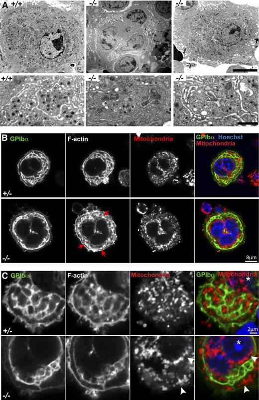 Figure 4. Tmod3−/− MKs show abnormal ultrastructure with incomplete DMS formation, abnormal organelle distribution, and defects in F-actin. (A) Representative TEM images of Tmod3+/+ and Tmod3−/− MKs at lower (upper panels) and higher (lower panels) magnification. All Tmod3+/+ MKs showed DMS tubules surrounding platelet territories with abundant electron-dense α-granules (left). In contrast, about half of Tmod3−/− MKs contained large clumps of vesicles (middle), whereas others appeared with some DMS tubules surrounding platelet territories, which were often larger and with fewer electron-dense granules (right). Bar, 5 µm (upper panels) and 1 µm (lower panels). (B-C) Immunofluorescence staining of GPIbα, F-actin, mitochondria (TOM20), and nuclei (Hoechst) in isolated Tmod3+/− and Tmod3−/− fetal liver MKs. Grayscale images are shown for each stain, and the merge shows GPIbα (green), mitochondria (red), and nuclei (blue). In Tmod3+/− MKs, GPIbα and F-actin are associated with DMS membranes surrounding platelet territories that contain mitochondria. Tmod3+/− MK morphology is indistinguishable from Tmod3+/+ (data not shown). In Tmod3−/− MKs, GPIbα-labeled DMS membranes form fewer territories, which are deficient in mitochondria, F-actin accumulates in abnormal foci (B, red arrows), and mitochondria aggregate in the cytoplasm and around the nucleus (C, white arrowheads). Images are single optical sections selected from Z stacks acquired using a Zeiss LSM 780 confocal laser scanning fluorescence microscope with a ×100 oil-immersion objective (N.A. 1.4) at zoom 2 (B) or zoom 5 (C). Asterisk in (C), nucleus. Bars, 8 μm (B); 2 µm (C).