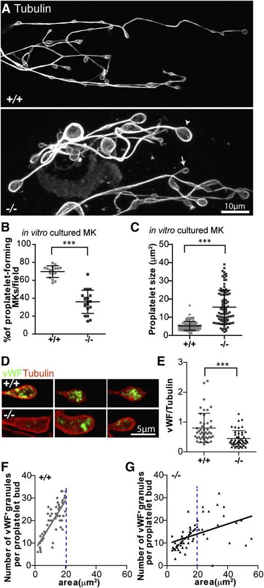 Figure 5. Proplaletet formation by Tmod3−/− MKs in culture is impaired, and Tmod3−/− proplatelets have abnormal levels of VWF+ granules. (A) Immunofluorescence staining of α-tubulin in proplatelets produced by MKs cultured in vitro from Tmod3+/+ and Tmod3−/− fetal livers reveals uniformly small sizes for Tmod3+/+, but highly variable sizes for Tmod3−/− proplatelets, including some very large ones. Arrowhead and arrow (lower panel) are examples of a large and small Tmod3−/− proplatelet, respectively. Bar, 10 µm. (B) Percentages of MKs cultured in vitro that form proplatelets. ***P < .001. (C) Sizes of proplatelet buds produced by cultured MKs. Tmod3+/+, 5.23 ± 2.39 µm2 (n = 96); Tmod3−/−, 15.48 ± 9.31 µm2 (n = 98). ***P < .001. Proplatelet sizes (areas, µm2) were measured from α-tubulin–stained proplatelets using Volocity 6.3 software to circle their perimeter. (D) Immunofluorescence staining of VWF (green) and α-tubulin (red) in proplatelet buds from cultured MKs. Bar, 5 µm. (E) Total VWF per proplatelet based on the ratio of VWF fluorescence intensity vs α-tubulin intensity. Tmod3+/+, 0.80 ± 0.49 (n = 46); Tmod3−/−, 0.45 ± 0.27 (n = 48). ***P < .001. (F-G) Number of VWF+-stained puncta per proplatelet bud with respect to area (solid grey line for Tmod3+/+, solid black line for Tmod3−/−). The number of VWF+ granules per proplatelet bud was linearly dependent on proplatelet area for Tmod3+/+ but not Tmod3−/− MKs (R2 = 0.6017 vs R2 = 0.2112, respectively). However, the subset of Tmod3−/− proplatelet buds with areas smaller than or equal to the area of the largest Tmod3+/+ proplatelet bud (demarcated by blue dotted line), revealed a stronger linear correlation (R2 = 0.4945, dashed black line). Thus, in Tmod3−/− proplatelets, the overall weakness of the linear relationship of the number of VWF+ granules per proplatelet bud as a function of proplatelet area is driven primarily by the unusually large, aberrant proplatelet buds. Images are single optical sections acquired using a Zeiss LSM 780 confocal laser scanning fluorescence microscope with a ×100 oil-immersion objective (N.A. 1.4) at zoom 0.6 (A) or zoom 2 (D).