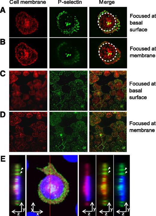 Figure 3. Spatially regulated α-granule secretion occurs at the basal platelet surface. (A) Total internal reflection fluorescence (TIRF) microscopy reveals that on platelets adhered and spread onto fibrinogen microdots (traced with dotted circle), anti–P-selectin staining (green) was clearly focused at the basal surface of the platelet membrane (red, cell membrane stain). (B) As the TIRF focal plane is elevated, the focus of the outer edges of the platelet membrane and anti–P-selectin staining at the granulomere center of the platelet sharpens, whereas the anti–P-selectin staining beyond the micropattern boundaries loses focus. (C) P-selectin expression localized to the submicron “holes” of the micropatterned protein matrix is clearly focused at the basal surface of the platelet membrane, whereas this focus is lost as the focal plane is elevated and focused at the outer edges of the platelet membrane (D). (E) The orthogonal sectional view of a platelet (red) on a fibrinogen microdot (blue). Strong expression of P-selectin (green) is detected in areas where platelet spreading extended beyond the geometric constraints of the microdot pattern, as well as at the granulomere center of the platelet. P-selectin expression beyond microdot pattern was also observed at the glass surface (arrows). All samples are permeabilized upon staining.