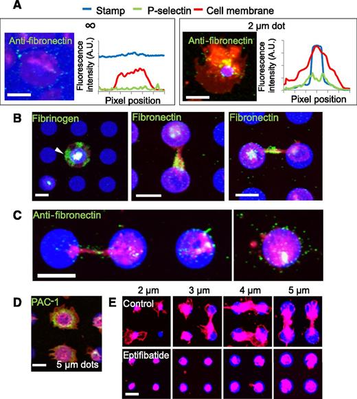 Figure 4. Matrix self-deposition by spatially regulated α-granule secretion supports platelet spreading beyond the geometric boundaries of the protein micropattern in an αIIbβ3-dependent manner. (A) Immunostaining with antifibronectin reveals that small amounts of fibronectin (green) colocalized with the platelet membrane (red) margins on platelets spread on evenly coated fibrinogen (blue) surfaces (left) but shows increased levels of fibronectin beyond the protein micropattern boundaries (right). Averaged (n = 5-8 platelets) fluorescence intensity line plots of fibronectin expression show that the fibronectin signal is highest at and immediately beyond the micropattern boundaries and not at the edge of platelet membrane. (B) Regions of platelets (red) that spread beyond the collagen microdot (blue) boundaries stain strongly with antifibrinogen (left, green, arrow). Strong expression of fibronectin was also observed at connections between 2 platelets adhered to adjacent protein microdots (middle), and also at the area around the connection (right). (C) Retraction of spread platelets via latrunculin A exposure reveal the deposited fibronectin (green) that remains on the surface after retraction of the platelet membrane. (D). Live cell staining with FITC-PAC-1 (green) shows high concentrations of activated αIIbβ3 integrins distributed at and beyond the geometric boundaries of fibrinogen microdots (blue). (E) When platelets (red) were treated with eptifibatide, an αIIbβ3 antagonist, platelet spreading beyond the geometric constraints of the collagen micropattern (blue) is completely inhibited. Platelets (B,E) were permeabilized upon staining. The scale bars= 5 µm.
