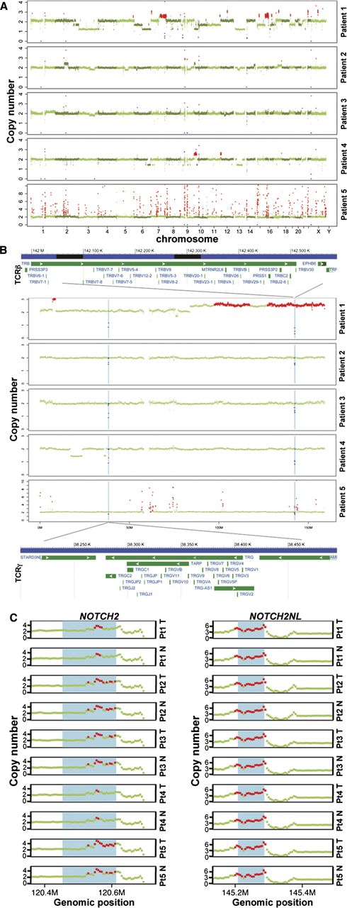 Figure 4. Copy-number alterations in MF tumor genomes. (A) FREEC detection of SCNAs in each patient. X-axis: genomic positions, ordered by chromosomes. Y-axis, copy numbers in tumor compared with the matched normal sample. A copy number of 2 indicates copy number neutral; red: gains, blue: losses, green: no change. (B) Deletion regions on chromosome 7 that involve T-cell receptor genes (annotations are based on human reference GRCh37/hg19); TRB: T-cell receptor β locus. TRG: T-cell receptor γ locus. (C) Amplification at the NOTCH2 and NOTCH2NL loci in normal (N) and tumor (T) of each patient (Pt). Red dots: copy number ≥3. The blue shade shows the respective gene region: NOTCH2 (chr1:120454176-120612317) and NOTCH2NL (chr1: 145209111-145285912) based on UCSC Genome Browser hg19. A copy number of 2 is neutral.