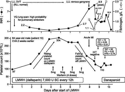 Figure 1. Representative case (patient 10). See “Representative cases” for further details. FFP, fresh frozen plasma; LLL, left lower limb; RLL, right lower limb; SC, subcutaneous; vit K, vitamin K; VQ, ventilation-perfusion.