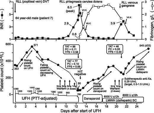 Figure 2. Representative case (patient 7). See “Representative cases” for further details. anti-Xa, anti–factor Xa; PTT, partial thromboplastin time.