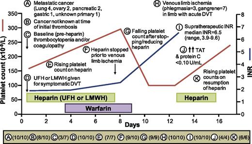 Figure 3. Schematic picture of 10 cancer patients with warfarin-associated venous limb ischemia. For 11 different clinical or laboratory features, labeled “A” through “K”, the number of patients illustrating that feature (numerator) among evaluable patients (denominator) is shown at the bottom of the figure. Note that for 8 of 10 patients (B), a diagnosis of cancer was not known or suspected at the time the patient presented with DVT. The reasons why the denominator is <10 for some features is as follows: (E and G) platelet count measurements not available (eg, outpatient treatment); (I and J) plasma samples not available (note that whereas plasma samples from 6 available patients showed elevated TAT levels, samples from only 4 patients were available from the time of onset of venous limb ischemia/gangrene; however, 4/4 patients showed PC activity levels ≤0.10 U/mL).