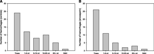 Figure 2. Volume histograms of intracranial hemorrhages. The distribution of all hemorrhages identified among control (A) and enoxaparin (B) cohorts are shown according to volume (mL). SAH, subarachnoid hemorrhage.