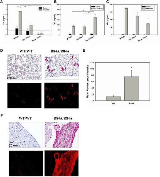 Figure 4. Thrombotic challenge of WT EPCRWT/R84A and EPCRR84A/R84A mice. (A) Anesthetized mice were given an IV injection (via tail vein) of bovine thrombin (1 nmol/kg) or 0.9% NaCl. At 8 minutes postinjection, blood samples were collected via the inferior vena cava (IVC) in the presence of 0.01 M benzamidine. APC levels were measured by enzyme capture assay. The solid line indicates the lower limit detection for the assay. (B-C) Anesthetized mice were given an IV injection (via tail vain) of 50 pmol/kg FXa and 75 nmol/kg phospholipid vesicles (PCPS) in the presence of 0.1% BSA and 2 mM CaCl2. At 10 minutes postinjection, blood samples were collected via the IVC. TAT (B) and APC (C) levels were measured by ELISA. (D) Immunohistochemical detection of fibrin deposition in the lungs after FXa/PCPS injection. Red alkaline phosphatase reaction product identifies fibrin under brightfield (top) and fluorescent (bottom) microscopy. (E) Fluorescence quantification shows that the MFI of fibrin staining is greater in the lungs of EPCRR84A/R84A mice when compared with WT mice. (F) Immunohistochemical detection of fibrin deposition in the ventricles of the heart after FXa/PCPS injection. Images are representative of 3 mice per group. Data represents the mean ± SE; *P < .05, **P < .01, ***P < .001; n > 3 per group. ELISA, enzyme-linked immunosorbent assay.