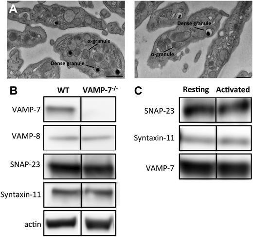 Figure 1. Characterization of VAMP-7–null platelets. (A) Transmission electron microscopy of platelets from wild-type (left) and VAMP-7−/− mice (right). Scale bars represent 0.5 μm. (B) Immunoblot analysis of lysates derived from wild-type and VAMP-7−/− platelets. (C) Immunoprecipitation of VAMP-7 from resting human platelets (Resting) and platelets stimulated with 5 μM SFLLRN (Activated). SNAP-23, syntaxin-11, and VAMP-7 were subsequently identified in immunoprecipitates using immunoblot analysis. WT, wild-type.