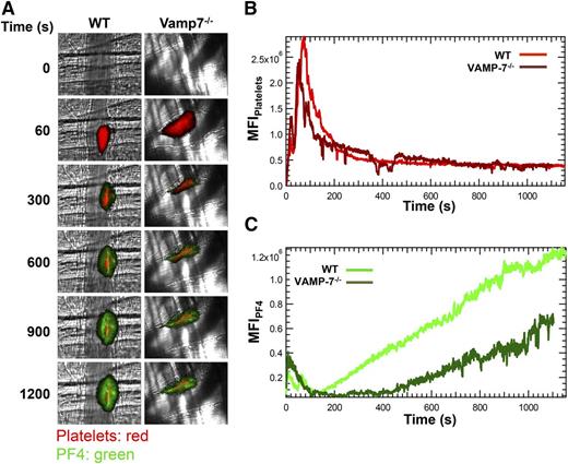 Figure 4. α Granule release during thrombus formation in vivo is impaired in VAMP-7−/− mice. (A) Platelet-specific anti-CD42b antibody conjugated to DyLight 649 (0.1 μg/g body weight) and anti-PF4 monoclonal antibody conjugated to Alexa Fluor 488 (0.5 μg/g body weight) were infused into the mice. Representative binarized images of the appearance of fluorescence signals associated with PF4 (green) and platelets (red) after laser-induced vessel wall injury in wild-type and VAMP-7−/− mice are shown. (B) Median integrated platelet fluorescence intensity in wild-type (light red) and VAMP-7−/− mice (dark red). (C) Median integrated PF4 fluorescence intensity at the injury site in wild-type (light green) and VAMP-7−/− mice (dark green) are plotted vs time. Wild-type mice, n = 28; VAMP-7−/− mice, n = 23.
