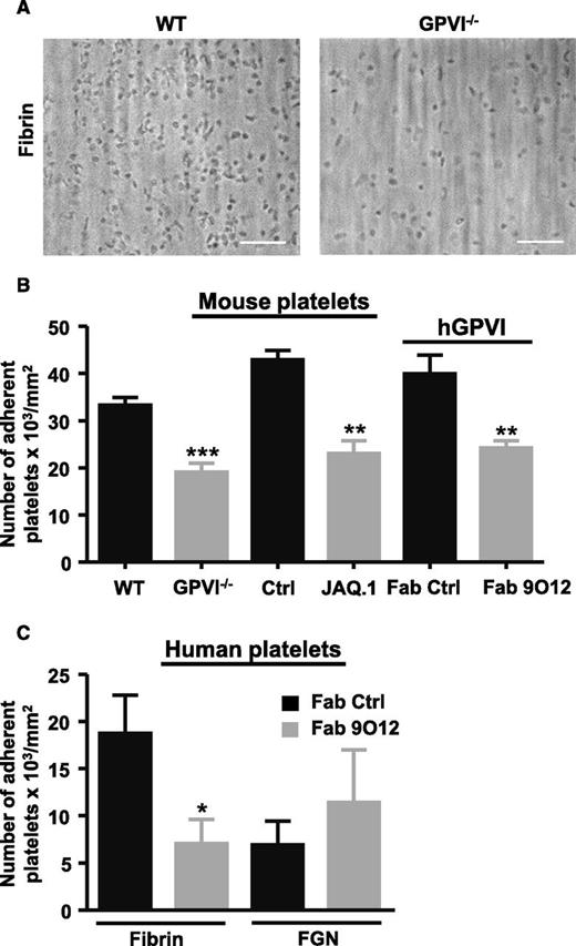 Figure 3. GPVI deficiency, immunodepletion, or blockade reduced platelet adhesion to fibrin. (A) Representative DIC microscopy images of WT and GPVI−/− mouse platelets adhering to polymeric fibrin (300 s−1, 3 minutes). Bar, 30 µm. (B-C) Bar graph represents the quantification of adherent platelets. (B) Hirudinated mouse whole blood perfused over fibrin; WT (n = 7); GPVI−/− (n = 7); Ctrl: mice injected with a control antibody (n = 6); JAQ.1: WT mice injected with JAQ.1 (n = 5); hGPVI mouse whole blood treated with a control Fab (n = 6) or the Fab 9O12 (n = 6). (C) Human whole blood treated with a control Fab (n = 6) or the Fab 9O12 (n = 6) perfused through fibrin or FGN-coated microcapillaries (300 s−1, 3 minutes). Mean ± SEM, *P < .05, **P < .01, ***P < .001, Mann-Whitney U test. Ctrl, control; DIC, differential interference contrast; hGPVI, human GPVI.