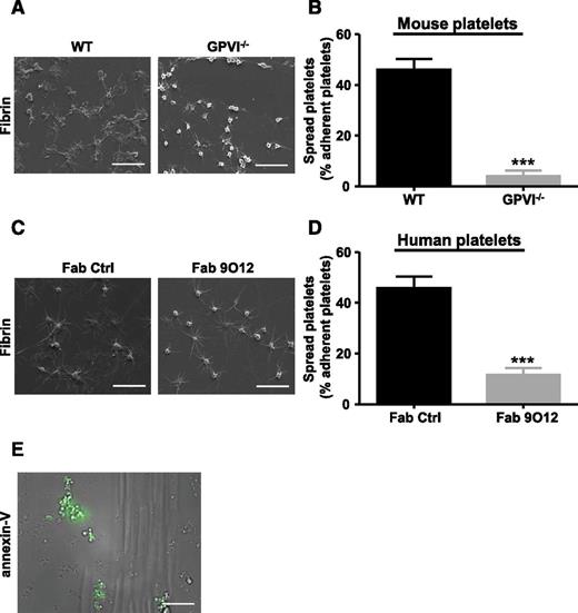 Figure 5. Spreading and procoagulant activity of platelets adhering to fibrin. (A-D) Hirudinated (A-B) mouse and (C-D) human whole blood was perfused over a fibrin surface at 300 s−1 for 3 minutes. The morphology of the platelets adhering to fibrin was examined by (A, C) SEM and the number of spread platelets was quantified for (B, D) each condition. Bar, 30 µm. (A-D) Platelets from (A-B) WT (n = 4) or GPVI−/− (n = 4) mice and from (C-D) human whole blood treated with a control Fab (n = 4) or the anti-GPVI Fab 9O12 (n = 4). (B, D) Quantification was performed on at least 10 images per condition. Mean ± SEM, *** P < .001, Mann-Whitney U test. (E) Hirudinated human whole blood was perfused over fibrin for 3 minutes at 300 s−1 and then the surface was rinsed with PBS for 10 minutes and perfused with annexin V-568 for 10 minutes. (E) Procoagulant platelets appeared as cells positive for annexin V staining (green) using epifluorescence microscopy. Bar, 30 µm. PBS, phosphate-buffered saline.