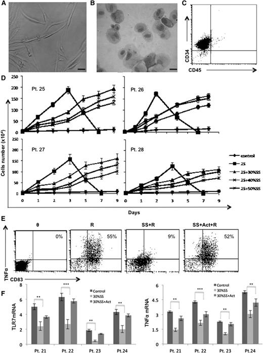 Figure 1. Effect of stromal factors on TLR7-signaling responses. (A) Morphology of CLL splenic stromal cells are shown by direct light microscopy or (B) following May-Grünwald/Giemsa-staining of a cytospin preparation. Scale bars, 1 mm. (C) Flow cytometry indicate the cells do not express the hematopoietic marker CD45. (D) 104 CLL cells were cultured alone or with IL-2 and resiquimod in the indicated concentrations of supernatant from confluent stromal cells cultured in AIM-V for 48 hours. Viable cells were counted daily for 9 days by trypan-blue exclusion. Averages and standard errors of 3 separate measurements are shown for 4 different patient samples. (E-F) CLL cells were cultured overnight in the presence or absence of 30% conditioned media with or without the IL-6 receptor antibody actemra (15 μg/ml) and then stimulated with resiquimod (1 μg/mL). Membrane TNF-α and CD83 expression were measured 4 hours later by flow cytometry. An example for patient #22 is shown (E) with similar results obtained for 8 other patient samples. Numbers in the top right quadrants indicate percentages of mTNF-α+CD83+ cells. (F) Before resiquimod activation, TLR7 (left panel) and TNFA (right panel) transcripts were measured by PCR and normalized to HPRT. Averages and standard errors of results from 3 independent measurements for 4 different patient samples are shown. **P < .01; ***P < .001. Act, actemra; Pt, patient; R, resiquimod; SS, stromal supernatant.