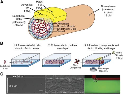 Figure 1. Recreating the in vivo FeCl3 model in a microfluidic platform. (A) Schematic of FeCl3 application (not to scale) in which a saturated 1 M FeCl3 patch is placed on the vessel adventitia. As the FeCl3 diffuses through the layers of the vessel wall, apparent concentration decreases, and at the luminal surface of the endothelial cells, the FeCl3 concentration is ≥50 mM. The dashed box at the luminal surface of the endothelial cells represents the location of interface of the solutions. (B) Endothelial cells are seeded in the large channel (250 μm) of a T-shaped microfluidic to recapitulate a blood vessel. FeCl3 is infused in the side channel (50 μm) and the blood/FeCl3 interface is visualized; shear stress 4 dyne/cm2. (C) Left to right, Bare microfluidic channel, endothelialized channel, and an example of fluid interface using fluorescent dyes and infusion rates of 2.7 μL per minute in large channel and 0.4 μL per minute in side channel. The dashed box represents the fluid interface that would be seen at the vessel wall in vivo. All scale bars represent 50 μm.