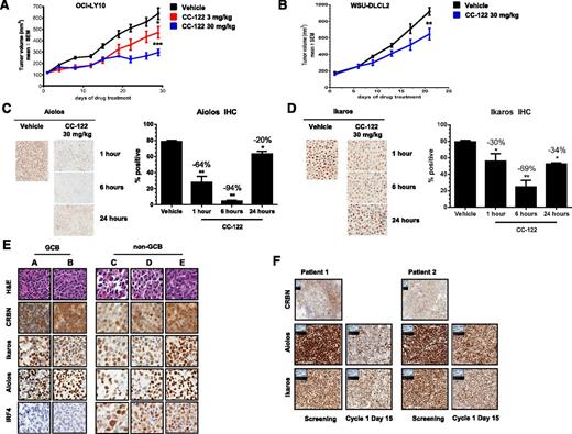 Figure 3. CC-122 reduces tumor growth and promotes degradation of Aiolos and Ikaros in vivo and in DLBCL patients. (A) CB-17 SCID mice with OCI-LY10 xenograft tumors were treated with either vehicle or 3 or 30 mg/kg CC-122 daily. The average tumor volume of each group (n = 10) ± standard deviation (SD) is shown as a function of time. *P = .028; ***P < .001 unpaired Student t test. (B) CB-17 SCID mice with WSU-DLCL2 xenograft tumors were treated with either vehicle or 30 mg/kg CC-122 daily. The average tumor volume of each group (n = 10) ± SD is shown as a function of time. **P < .01 unpaired Student t test. (C and D) WSU-DLCL2 xenograft tumor samples were harvested at indicated time points after final dosing with either vehicle or CC-122 (30 mg/kg). Tissues were then subjected to FFPE IHC for Aiolos and Ikaros. Graphical representation of Aiolos and Ikaros degradation (mean ± SEM). *P < .01; **P < .001 1-way analysis of variance followed by Dunnett’s multiple comparison test. (E) Representative fields of DLBCL formalin fixed paraffin embedded (FFPE) samples stained with hematoxylin and eosin (H&E), CRBN, Aiolos, Ikaros, and IRF4. (F) Representative fields of FFPE samples from GCB R/R-DLBCL patients administered with 3 mg of CC-122 daily. Screening and cycle 1 day 15 biopsies were immunohistochemically stained with Aiolos, Ikaros, and CRBN antibodies as indicated.