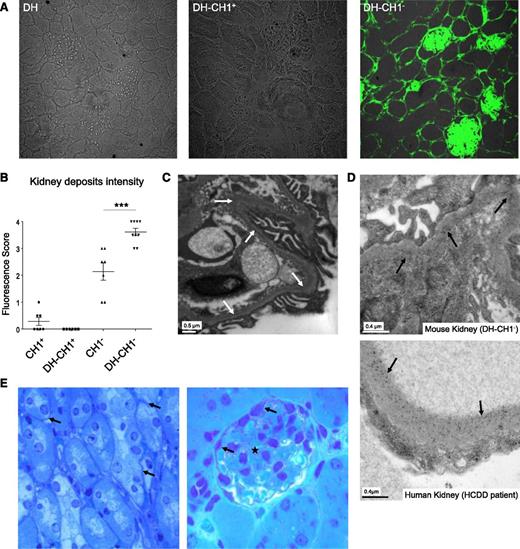 Figure 3. HCDD transgenic mice reproduce human kidney lesions. (A) Immunofluorescence microscopy on DH, DH-CH1+, or DH-CH1− kidney sections with an anti-human γHC-fluorescein isothiocyanate. Fluorescence and differential interference contrast are merged. Original magnification, ×400. Note the intense linear staining of tubular and glomerular BMs and in the mesangium of the DH-CH1− kidney. (B) Deposit intensity based on immunofluorescence studies of kidney sections. Each dot represents a score of fluorescence from an individual kidney as described in Materials and Methods. Means ± SEM are shown (n = 6-9 mice in 3 independent experiments; ***P < .001). (C) Electron micrograph of kidney from a DH-CH1− mouse showing finely granular electron-dense deposits along the inner part of the lamina densa of a glomerular-capillary BMs (arrows). Original magnification, ×20 000; scale bar is indicated. (D) Immunoelectron microscopy on kidney from a DH-CH1− mouse (top) and a renal biopsy of the corresponding HCDD patient (bottom). Note the presence of anti–γHC-conjugated gold particles along the BMs in both patient and mice kidneys. Original magnification, ×50 000; scale bars are indicated. (E) Toluidine blue staining showing a faint diffuse thickening of tubular BMs in the outer medulla (left) and glomerular BMs (arrows). Deposits are also observed in the mesangium (star). Original magnification, ×600.