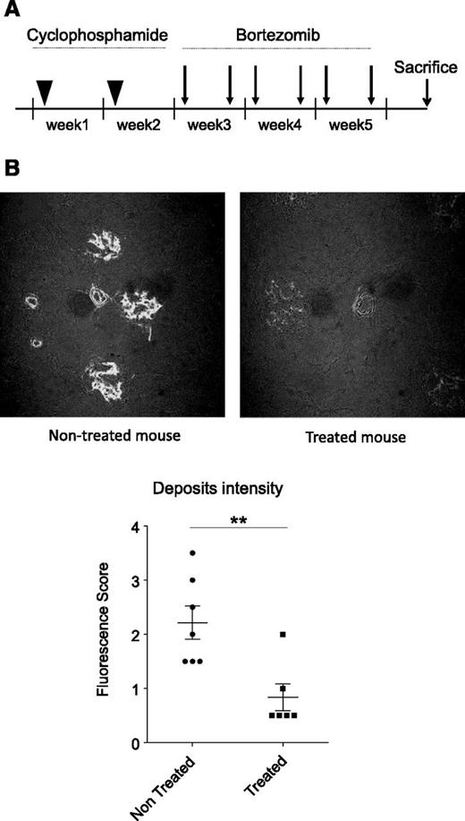 Figure 5. Hematologic treatment reduces the onset of kidney deposits. (A) Therapeutic protocol applied to deplete B and plasma cells in CH1− mice. (B) (Upper) Representative immunofluorescence on kidney sections of treated or nontreated CH1− mice with an anti-human γHC-fluorescein isothiocyanate. Original magnification, ×400. (Lower) Comparison of deposit intensity in kidney sections of treated vs nontreated CH1− mice. Each dot represents the score of fluorescence from an individual kidney. Means ± SEM are shown (n = 6-7 mice in 2 independent experiments; **P < .01).