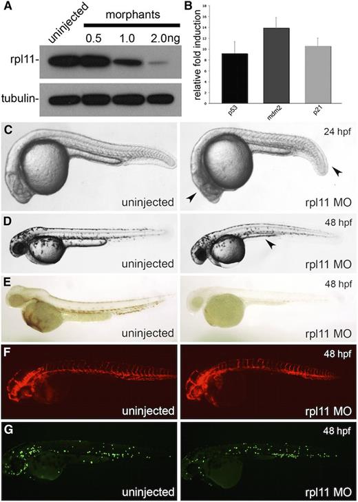 Figure 1. Knockdown of Rpl11 in zebrafish embryos model the erythroid and developmental defect in DBA. Rpl11 in embryos were targeted using a translational start codon morpholino. (A) Western blot against Rpl11 in 24 hpf embryos injected with various doses of morpholino. (B) Transcript quantification of p53, mdm2, and p21 at 24 hpf. (C-D) Morphologic features of morphants at 24 hpf (C) and 48 hpf (D). Arrowheads point to the defective head development and shorted tail extension at 24 hpf. At 48 hpf, a smaller head, edema, and defective yolk extension were observed (arrowhead) in morphants. (E) o-Dianisidine staining of zebrafish embryos at 48 hpf. (F) Flk:dsred transgenic zebrafish at 48 hpf. (G) Mpo:EGFP transgenic zebrafish at 48 hpf.