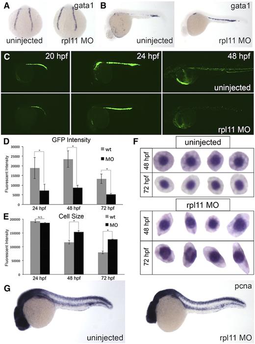 Figure 2. Terminal differentiation and proliferation, but not specification, are defective in RPL11 deficiency. Erythroid cells at various stages of development were analyzed. (A-B) In situ hybridization for gata1 expression. (A) Four somites stage. (B) 30 hpf. (C) Time course of morphants in LCR2:EGFP transgenic zebrafish. (D-E) Flow cytometry analysis of EGFP-positive cells. (D) EGFP intensity. (E) Cell size, measured by forward scatter; *P < .05. (F) Wright-Giemsa staining of isolated erythroid cells collected from zebrafish embryos. (G) In situ hybridization for PCNA in uninjected or morpholino-injected embryos. Observed phenotype (G): uninjected = 24/24 morphants = 23/25.