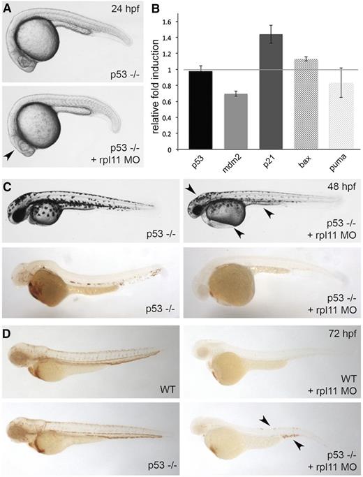 Figure 3. Inhibition of p53 partially restored erythroid levels at later stages of development. Rpl11 morpholino was injected in p53-null zebrafish embryos. (A) Morphology of p53-null zebrafish embryos at 24 hpf. The arrowhead indicates the recovery of aplasia in the head. (B) Transcript quantification for p53 and genes downstream of p53: mdm2, p21, bax, and puma at 24 hpf. (C, top) Morphology of p53-null zebrafish embryos at 48 hpf. The arrowhead points to the presence of a smaller head, edema, and defective yolk extension. (C, bottom) o-Dianisidine staining of embryos reveals lack of hemoglobin-positive cells. (D) o-Dianisidine staining of wild-type (WT) (top) or p53-null (bottom) embryos at 72 hpf. The arrowhead points to the recovery of erythroid cells in p53-null embryos. Observed phenotype (D): WT + rpl11 MO = 40/40 p53(−/−) + rpl11 MO = 30/40.