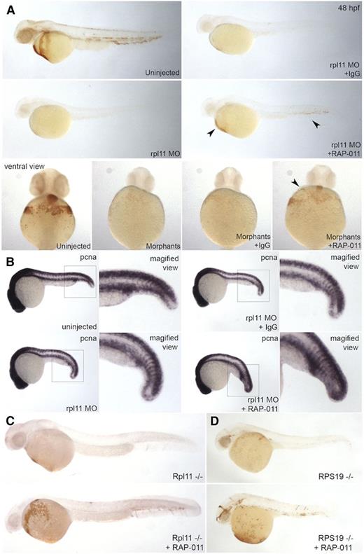 Figure 5. RAP-011 can restore erythroid levels in ribosome-deficient embryos. (A) Rpl11 morpholino-injected embryos were treated with IgG or RAP-011. Staining of 48 hpf embryos with o-Dianisidine shows a partial recovery (seen in ∼87.0% of embryos; P < .05) of globin-positive cells (arrows). (B) In situ hybridization for PCNA expression in morpholino-injected embryos, 24 hpf, treated with IgG or RAP-011. Rescue by PCNA staining seen in ∼87.2% of embryos; P < .05. (C-D) o-Dianisidine staining of RPL11 or RPS19-mutant embryos treated with RAP-011. Observed phenotype (A): Rpl11 MO + IgG = 32/32 Rpl11 MO + RAP-011 = 54/62; (B): Rpl11 MO + IgG = 58/58 Rpl11 MO + RAP-011 = 41/47; (C): Rpl11(−/−) = 15/15 Rpl11(−/−) + RAP-011 = 10/10; (D): Rps19(−/−) = 8/8 Rps19(−/−) + RAP-011 = 12/12.