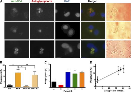 Figure 2. Phagocytosis of C3dg-coated PNH erythrocytes by activated human monocytes. (A) Visualization of intracellular erythrocytes by fluorescent microscopy. The processes of phagocytosis and immunostaining are described in Methods. PNH erythrocytes were identified by positive staining with anti-C3d and anti-glycophorin antibodies. (B) Phagocytosis quantification. The results represent the average of 3 independent experiments, and the error bars represent the standard deviation. In each phagocytosis experiment, activated human monocytes were incubated with erythrocytes from a healthy donor (Ctrl) or PNH patient E (panel C). To test whether the phagocytosis is accomplished via CR3, a CR3-specific blocking antibody was preincubated with activated monocytes before adding the PNH erythrocytes, and a blocking anti-CR2 mAb was used as a nonspecific control (n = 3; *P < .05, 1-way analysis of variance). (C-D) Correlation between phagocytosis efficiency by activated human monocytes and C3dg coating of PNH erythrocytes. Phagocytosis experiments were performed with erythrocytes from 5 different PNH patients. The data in C represent the average of 3 independent experiments with error bars indicating the standard deviation. (D) Correlation between the fraction of C3dg-positive cells (supplemental Figure 4) and erythrophagocytosis (C), with error bars indicating the standard deviation (Pearson r = 0.99; P = .002).