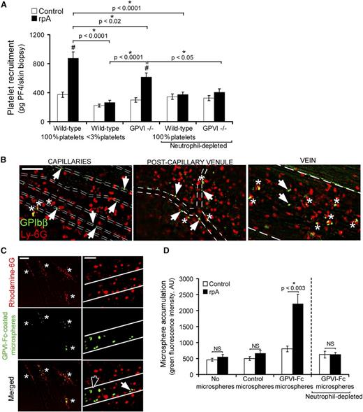 Figure 5. GPVI mediates vascular repair following neutrophil-induced injury. (A) Comparison of platelet accumulation at unstimulated control sites or at the site of the rpA reaction in the skin of control wild-type, thrombocytopenic, and GPVI−/− mice, as assessed by measurement of skin PF4 content. n = 6-15 mice per group. # indicates a significant difference (P < .0001) as compared with the PF4 content in unstimulated control skin of wild-type mice. (B) Platelets and neutrophils were stained in vivo using fluorescent antibodies to GPIbβ and Ly-6G, respectively, and their interactions with vessels during the rpA reaction were analyzed by intravital microscopy through a dorsal skinfold chamber. Whether at the capillary, postcapillary venule, or vein level, single platelets were seen binding directly to the vessel lining (white arrowheads) or to adherent neutrophils (white asterisks). Vessel edges are highlighted by dotted lines. The images shown were taken between 90 minutes and 2 hours after inducing the rpA reaction and are representative of 4 independent experiments. Scale bar, 100 µm. (C) The interactions of fluorescent microspheres (2 µm diameter) coated with a chimeric form of GPVI (GPVI-Fc) with the inflamed vasculature were analyzed by intravital microscopy. GPVI-Fc-coated microspheres accumulated specifically at sites of leukocyte recruitment and infiltration (white asterisks) identified by rhodamine-6G labeling. Observation of the GPVI-Fc–coated microspheres at higher magnification revealed individual microspheres binding directly to the vessel wall (black arrowhead) or to adherent leukocytes (white arrowhead). Vessel edges are highlighted in white. Scale bars, 200 µm (left) and 50 µm (right). The images shown are representative of 4 independent experiments. (D) Quantification of control and GPVI-Fc–coated microsphere accumulation at unstimulated control sites or at the site of the rpA reaction in the skin of wild-type mice that were immunodepleted or not for neutrophils, as indicated. n = 5-8 mice per group. NS, not significant.