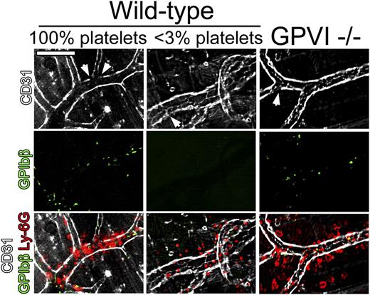 Figure 6. Neutrophil infiltration and endothelial integrity during the early phase of the cutaneous rpA reaction. The integrity of the endothelial cell layer at sites of neutrophil infiltration during the cutaneous rpA reaction was investigated by intravital microscopy. Endothelial cells, platelets, and neutrophils were stained using fluorescent antibodies to CD31, GPIbβ, and Ly-6G, respectively. In all groups of mice, although faint CD31 staining (arrowheads) was found in areas of neutrophil infiltration, the endothelial cell layer was overall well preserved. All pictures were taken during the first 3 hours of reaction. Scale bar, 100 µm.