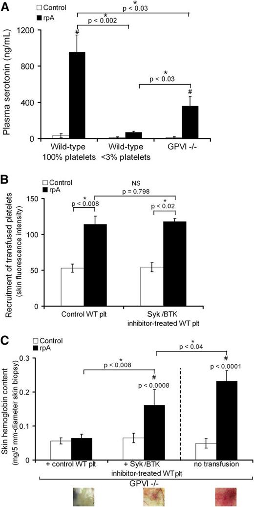 Figure 7. GPVI-dependent signaling contributes to platelet secretion and prevention of bleeding during the cutaneous rpA reaction. (A) Plasma serotonin levels in control (100% platelets), thrombocytopenic (<3% platelets), and GPVI−/− mice that were subjected or not to the cutaneous rpA reaction. n = 5-8 mice per group. # indicates a significant difference (P < .002) as compared with plasma serotonin level in unchallenged control wild-type mice. (B) GPVI−/− mice were transfused with 9 × 106 green-fluorescent calcein-AM–labeled wild-type platelets that were treated or not with the Syk inhibitor R406 and the Btk inhibitor ibrutinib, as indicated. The cutaneous rpA reaction was then elicited, and the recruitment of transfused platelets to the reaction site was quantified by measurement of green fluorescence intensity in extracts from skin biopsy specimens harvested after 4 hours of reaction. (C) Hemoglobin content in skin biopsy specimens from control and rpA reaction areas from GPVI−/− mice and from GPVI−/− mice that were transfused with control or Syk/Btk-inhibitor–treated wild-type platelets. n = 4-8 mice per group. # indicates a statistically significant difference (P < .05) in hemoglobin content as compared with control spots from GPVI−/− mice transfused with control wild-type platelets. Representative pictures of the skin at the site of the rpA reaction are shown below. NS, not significant; WT, wild-type.