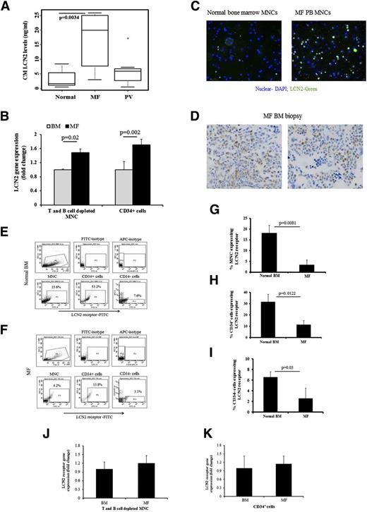 Figure 2. LCN2 levels are elevated in PMF MNC-CM, and LCN2 is localized to MF marrow myeloid cells. (A) LCN2 levels in media conditioned with MF or PV MNCs (n = 10 and n = 7, respectively) and normal bone marrow MNCs (n = 10) after incubation in serum-free expansion medium containing stem cell factor, thrombopoietin, fms-like tyrosine kinase 3 ligand, and interleukin-3 for 1 day (Kruskal-Wallis nonparametric ANOVA; P < .0034 comparing normal vs MF and PV vs MF). (B) qRT-PCR results showed that LCN2 transcript levels were greater in MF T- and B-cell–depleted MNCs, as well as in MF CD34+ cells (repeated-measures ANOVA F test; P = .02 and P = .002, respectively; n = 5). (C) Immunofluorescence staining with an anti-LCN2 antibody showing LCN2 (green) presented in normal and MF MNCs; nuclei were stained with DAPI (original magnification ×200). A greater proportion of MF MNCs expressed LCN2 compared to normal MNCs. (D) Photomicrograph demonstrating LCN2 expression by cells within a bone marrow biopsy specimen from an MF patient by staining with a LCN2 monoclonal antibody (clone 5G5, dilution 1:25, Abcam). LCN2 was expressed by myeloid cells but not by erythroid precursors or megakaryocytes (original magnification ×400). Flow cytometric analysis of LCN2 receptor expression by CD34+ cells and normal BM MNCs (E) and MF MNCs (F). (G) A greater proportion of normal BM MNCs (n = 5) expressed the LCN2 receptor as compared to MF MNCs (n = 6) (Wilcoxon rank sum test; P = .008). (H) Similarly, a greater proportion of normal BM CD34+ cells (n = 5) expressed the LCN2 receptor as compared to MF CD34+ cells (n = 5) (Wilcoxon rank sum test; P = .012). (I) A greater proportion of normal BM CD34− cells (n = 5) expressed the LCN2 receptor as compared to MF CD34− cells (n = 5) (Wilcoxon rank sum test; P = .03). (J) qRT-PCR studies indicated that LCN2 receptor gene expression was similar in both MF and normal T- and B-cell–depleted MNC cells samples. (K) qRT-PCR studies indicated that that LCN2 receptor gene expression was similar in both MF and normal CD34+ cells. DAPI, 4,6 diamidino-2-phenylindole.