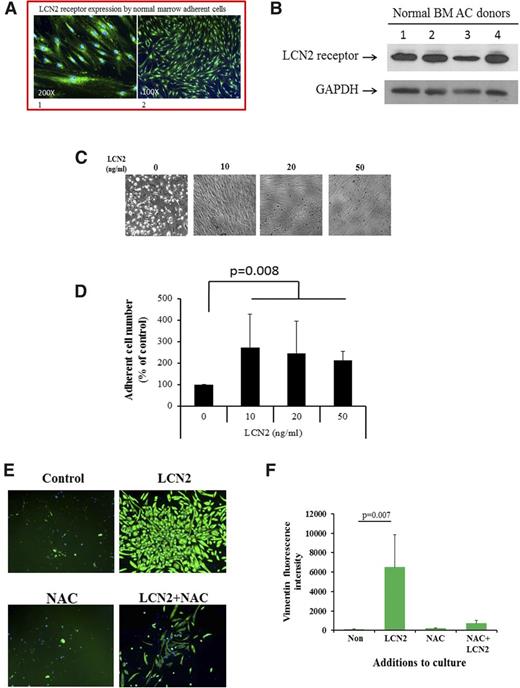 Figure 5. LCN2 promotes the proliferation of BM stromal cells that express the LCN2 receptor. (A) Immunofluorescence staining using an anti-LCN2 receptor antibody (SLC22A17) indicating that normal BM ACs express the LCN2 receptor (green). The nuclei were stained with DAPI. Images represent the analysis of ACs from 2 different donors. (B) Western blot analysis of 4 different samples of normal BM ACs indicated the expression of the LCN2 receptor. (C) Phase-contrast microscopy showing AC confluence that occurred after the culture of BM MNCs with 0, 10, 20, and 50 ng/mL of LCN2 (original magnification ×200). (D) The degree of AC proliferation was assessed with the PrestoBlue Cell Viability Reagent; cell numbers were determined on the basis of fluorescence intensity at 560 nm. LCN2 treatment led to the generation of greater numbers of ACs by normal marrow MNCs (repeated-measures ANOVA F test; P = .008; n = 7). (E) Immunofluorescence analysis of vimentin expression showed that AC proliferation was impaired by the addition of NAC to LCN2-containing cultures. Similar results were obtained with 3 additional BM MNC samples; NAC alone did not affect AC proliferation. (F) Analysis of fluorescence intensity of vimentin expression showed a significantly increased expression in ACs from BM MNCs cultured with LCN2 alone (repeated-measures ANOVA F test; P = .007; n = 4), which was not observed with the addition of NAC alone or NAC plus LCN2. GAPDH, glyceraldehyde-3-phosphate dehydrogenase.
