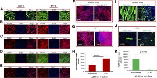 Figure 6. Phenotype of ACs treated with LCN2, and lineage differentiation potential of LCN2-treated ACs. Immunolabeling of MACs cultured in the presence or absence of LCN2. The ACs cultured under each of these conditions expressed vimentin+ (green) (A); α-smooth muscle actin (α-SMA+) (red) (B); CD105+ (red) (C); CD106 (green) (D); and CD90 (red) (E) (original magnification ×200). (F) Immunostaining of BM ACs that were preincubated with MSC culture medium alone for 10 days and then cultured with medium that promoted osteogenesis for 21 days. (G) Immunostaining of BM ACs that had been pretreated with LCN2 in MSC culture medium and then cultured under osteoblast-inducing conditions. Osteoblastic differentiation of MSCs was clearly enhanced by preincubation with LCN2 for 10 days; an anti-osteocalcin antibody was used to identify osteoblasts; cell nuclei were stained with DAPI. (H) The fluorescence intensity of osteocalcin was significantly increased in BM ACs pretreated with LCN2 (repeated-measures ANOVA F test; P = .0015; n = 6). (I) Immunostaining showed a greater number of adipocytes in BM ACs cultured in the MSC medium and then exposed to adipogenesis medium. (J) Immunostaining revealed that adipogenesis was diminished by pretreatment of BM ACs with LCN2 for 10 days and then cultured in adipogenesis medium. Anti-FABP4 (fatty acid–binding protein 4) antibody was used to identify adipocytes; cell nuclei were stained with DAPI. (K) Fluorescence intensity analysis revealed significantly decreased FABP4 protein expression in BM AC pretreated with LCN2 (repeated-measures ANOVA F test; P < .0001; n = 6).