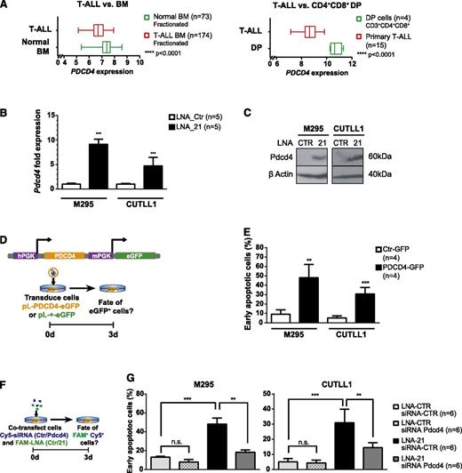 Figure 6. Overexpression of the miR-21 target gene PDCD4 induces apoptosis in T-ALL. (A) Box plot expression analysis of PDCD4 on RNA extracted from fractionated BM aspirates of 174 T-ALL patients and 73 normal controls (left panel), expression data publicly accessible through Leukemia Gene Atlas40 and on RNA extracted of FACS-sorted CD3+CD4+CD8+ primary human thymocytes (n = 4) compared with primary T-ALL specimens (n = 15), expression data publicly accessible through gene expression omnibus (GEO) data set browser (GSE6200635) (right panel). (B) Pdcd4 qRT-PCR performed on FAM+ mouse M295 and human CUTLL1 T-ALL cells after FAM-LNA-mediated miR-21 KD (or control transfection). Data were pooled from 2 independent experiments. (C) Western blot analysis for PDCD4 in M295 and CUTLL1 T-ALL cells was performed 3 days p.tr. T-ALL cells were transfected with FAM-LNA-Ctr or FAM-LNA-21 for miR-21 KD, and protein lysates of FACS-sorted cells were assessed for PDCD4 expression. (D) Overexpression of PDCD4 in T-ALL. A lentivirus-based system was employed to overexpress human PDCD4 in T-ALL cells. PDCD4 and eGFP contain 2 independent PGK promoters (upper panel). Experimental protocol: T-ALL cells were transduced with control virus (pL-+-eGFP) or PDCD4 overexpression virus (pL-PDCD4-eGFP) and analyzed for apoptosis induction 3 days following transduction (lower panel). (E) T-ALL cell lines M295 and CUTLL1 strongly induce early apoptosis (eGFP+, 7-AAD− Annexin-V+ cells) after 3 days in PDCD4 transduced cells compared with control. (F) Double KD experiment to simultaneously downregulate miR-21 and Pdcd4 to quantify apoptosis induction in T-ALL cells. T-ALL cells were cotransfected with Cy5-coupled siRNAs (Ctr or a mix of 2 independent siRNAs targeting human or mouse Pdcd4) and FAM-coupled LNAs (Ctr or miR-21). Three days p.tr., Cy5+FAM+ cells were assessed for apoptosis induction (G). Cy5+FAM+ T-ALL cells generated through the experimental protocol in panel F were assessed for early apoptosis (7-AAD− Annexin-V+ cells). miR-21 and Pdcd4 double KD cells were compared with cells that were transfected only with miR-21 KD (LNA-21 and siRNA-Ctr) or transfected with control oligonucleotides (LNA-Ctr and siRNA-Ctr) and cells where only Pdcd4 was downregulated (LNA-Ctr and siRNA-Pdcd4). Data (B, E, G) are pooled from 2 independent experiments. *P < .05; **P < .01; ***P < .001.