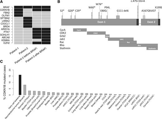 Figure 1. Recurrent CDKN1B mutations in classical HCL. (A) Cancer consensus and COSMIC annotated gene mutations identified in HCL by whole exome sequencing. Patient 3 progressed after vemurafenib treatment and was sequenced before and after BRAFi (vemurafenib) treatment. Exome sequencing identified recurrent inactivating somatic mutations of CDKN1B (for complete list of somatic mutations see supplemental Table 1b). (B) Gene regions of CDKN1B and distribution of mutations in HCL. Binding regions of important interaction partners are shown below the gene diagram. There were 17 CDKN1B mutations identified in 13 patients. In cases in which normal material was not available for the remaining mutations with sufficient read coverage (mean = 1259 reads, supplemental Table 1) the allele frequencies indicated somatic origin (supplemental Figure 2). (C) Frequency of CDKN1B mutations across cancer entities. Mutation frequencies were obtained from http://www.cbioportal.org/public-portal/.15 HCL shows the highest CDKN1B mutations frequency in cancer. ACyC, adenoid cystic carcinoma; CCLE, Cancer Cell Line Encyclopedia; ccRCC, clear cell renal cell carcinoma; GBM, glioblastoma multiforme; MM, Multiple myelomach; pRCC, papillary renal cell carcinoma; RCC, chromophobe renal cell carcinoma.