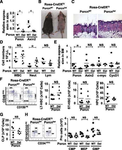 Figure 1. Porcn inactivation blocks Wnt signaling and caused alopecia in adult mice, but did not impair hematopoiesis. (A) Inactivation of Porcn downregulated expression of Wnt/β-catenin target gene (Axin2) in skin samples of Rosa-CreERT2/PorcnDel mice. Expression was normalized to PGK. The mean values of PorcnWT samples were set to 1 within each group (n = 4 mice in each group, 2 independent experiments, *P < .05, Mann-Whitney test). (B) Tamoxifen supplementation in chow for 3 weeks caused progressive alopecia in mice. Photo taken 7 weeks after start of tamoxifen. (C) Loss of hair follicles in skin after Porcn inactivation. H&E stain. Scale bar = 200 μm. (D) CBC after deletion of Porcn (5-6 weeks after tamoxifen chow administration). Total WBC and lymphocyte counts did not differ significantly between Rosa-CreERT2/PorcnWT (n = 5) and PorcnDel mice (n = 9) (*P < .05; Mann-Whitney test), whereas neutrophils were modestly increased (representative data of 4 independent experiments, P = .019, Mann-Whitney test). (E) Porcn was downregulated in BM of Porcn-inactivated mice 4 weeks after tamoxifen chow administration. Expression assessed by qRT-PCR was normalized to PGK and β-actin. Individual expression was normalized to mean of respective PorcnWT samples within the same group (n = 6; 2 independent experiments; *P < .01; Mann-Whitney test). (F) The total number of LT-HSCs (Lin−, Sca1+, c-Kit+, CD150+, CD48−), ST-HSCs (Lin−, Sca1+,c-Kit+, CD150−, CD48−), and HPCs (Lin−, Sca1+,c-Kit+, CD150−, CD48+) did not differ between Rosa-CreERT2/PorcnWT and PorcnDel mice (right panel). Representative flow cytometry data are shown in left panel (n = 6, cell number per 1 leg, 2 independent experiments, P > .05, Mann-Whitney test). (G) Total CLP cells (1 leg) were similar in Rosa-CreERT2/PorcnWT and PorcnDel mice 4 weeks after tamoxifen (n = 6 in each group, P > .05, Mann-Whitney test). (H) Total number of myeloid progenitor cells (1 leg) were similar in Rosa-CreERT2/PorcnWT and PorcnDel mice (middle and right panels) (n = 6 mice, 4 independent experiments, P > .05, Mann-Whitney test). Left panel, The representative gating for CMP, MEP, and GMP. H&E, hematoxylin and eosin; NS, not significant.