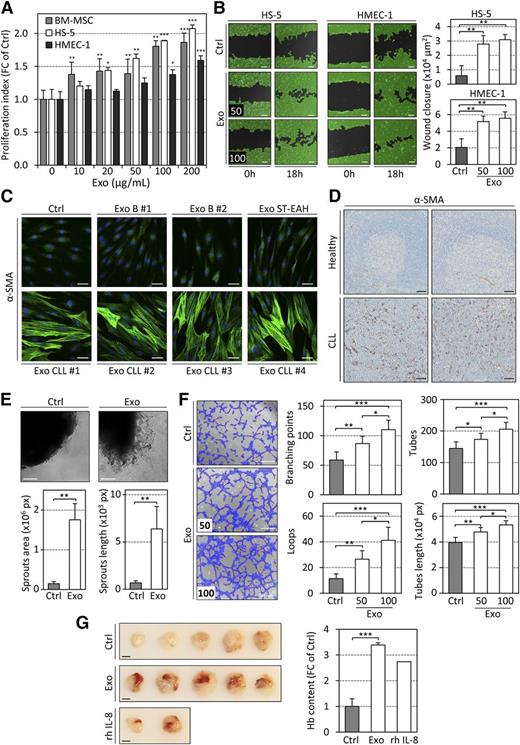 Figure 6. CLL exosomes promote cell proliferation, remodeling of the actin cytoskeleton, cell migration, and angiogenesis in vitro and in vivo. (A) Proliferation index of stromal cells after 96 hours of incubation with increasing concentrations of CLL exosomes (MEC-1) assessed using CCK8 assay. Data are reported as fold change (FC) of Ctrl (n = 4). *P < .05, **P < .01, ***P < .001. (B) Microscopy images of wound healing assay showing closure of the scratch when HS-5 or HMEC-1 cells were cultured in the absence (Ctrl) or presence (Exo) of 50 or 100 µg/mL CLL exosomes (MEC-1) in serum-free medium for 18 hours (left). Scale bar, 100 µm. Wound closure (×104 µm2) was quantified from images using WimScratch (Wimasis; n = 4) (right). **P < .01. (C) Representative images of immunofluorescence staining of α-SMA (green) in primary BM-MSCs untreated (Ctrl) or treated (Exo) for 15 days with exosomes produced by healthy donor B cells (B), lymphoblastoid cell line (ST-EAH), or primary CLL cells, captured by confocal microscopy (nucleus stained with DAPI, blue). Scale bar, 50 µm. (D) Representative images of immunohistochemistry staining of α-SMA in paraffin-embedded sections of human lymph nodes from 2 healthy individuals or 2 CLL patients (representative of n = 5). Scale bar, 50 µm. (E) (Upper) C57BL/6 mouse aorta pieces were incubated in vitro in the absence (Ctrl) or presence (Exo) of 100 µg/mL CLL exosomes (MEC-1) for 7 days. Representative microscopy images are shown. Scale bar, 100 µm. (Lower) Quantification of sprouts area and length using WimSprout (Wimasis; n = 4 replicates). **P < .01. (F) (Left) HMEC-1 cells untreated (Ctrl) or treated for 30 minutes with 50 or 100 µg/mL CLL exosomes (MEC-1; Exo) and then seeded on Matrigel for 3 hours. Scale bar, 100 µm. (Right) Quantification of several parameters of the tube formation assay using WimTube (Wimasis; n = 4). *P < .05, **P < .01, ***P < .001. (G) Matrigel plug assay performed by subcutaneous injection of Matrigel mixed with PBS (Ctrl) or 100 µg of CLL exosomes (MEC-1; Exo) in 5 NSG mice. rhIL-8 was used as positive control. (Left) Images depict surgically removed Matrigel plugs after 14 days. Scale bar, 5 mm. (Right) Quantification of hemoglobin content in Matrigel plugs using Drabkin reagent. Data are reported as FC of Ctrl (n = 5). ***P < .001.