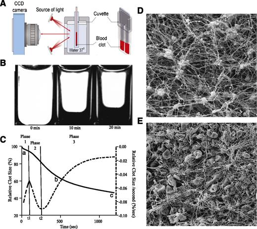 Figure 1. Schematic of the optical analyzer system. (A) Blood samples were added to the cuvette and allowed to clot. The cuvette was placed in the thermostat and exposed to light every 15 seconds, and images were recorded using a charge-coupled device (CCD) camera. (B) Images of blood clots during the process of contraction. (C) Data on clot size were compiled into a time course (kinetic) curve (solid line) with the following parameters extracted: lag time – time to 95% relative clot size (a), AUC (b), and final degree of contraction (c). The original curve of kinetics is segregated to the 3 parts (phase 1, phase 2, and phase 3) determined by assessing the local maximum and minimum of the instantaneous first derivative (dashed). Phase 1 shows the initial exponential phase of contraction; k1 is the rate constant associated with this phase of contraction. Phase 2 shows the middle linear region of contraction; k2 corresponds to the slope or rate of contraction in this region. Phase 3 shows the final phase of contraction, an exponential phase, and k3 corresponds to rate constant at which this decay occurs. Scanning electron microscopy was used to visually compare the ultrastructures of contracted blood clots in platelet-rich plasma (PRP) (D) and whole blood (E). Note that in PRP (D) fibrin fibers radiate from platelet aggregates and form bundles that likely propagate tension produced by the contracting platelets. In whole blood (E), the regular platelet-fibrin meshwork is partially impaired by RBCs that change the ability of fibrin to propagate the contractile force generated by platelets.