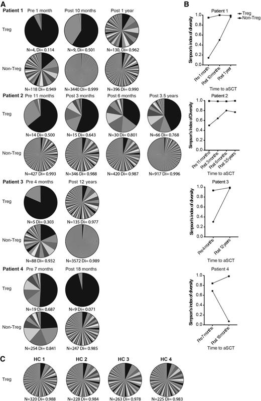 Figure 4. Successful autologous HSCT leads to a renewed and more diverse Treg TCR repertoire. (A) Tregs and non-Tregs from different blood collections of 4 HSCT-treated patients with refractory AID were sorted. These cell samples were used for TCR TCRβ sequencing. Per patient, each time point of blood sampling is shown. Per time point, 2 pie charts show the number and abundance of TCR sequences found for the Tregs and non-Tregs sorted from that cell sample. Color overlap between different pie charts does not represent the same TCR sequence. N represents the number of different TCR sequences found per sample, Di indicates the sample’s diversity (0 = no diversity, 1 = maximal diversity). (B) For patients 1 to 4, the changes in Di prior to HSCT and during follow up is shown in graphs. (C) TCRβ sequencing results of Tregs derived from 4 healthy controls are shown in a similar fashion as in panel A. aSCT, autologous stem cell transplantation; HC, healthy controls.