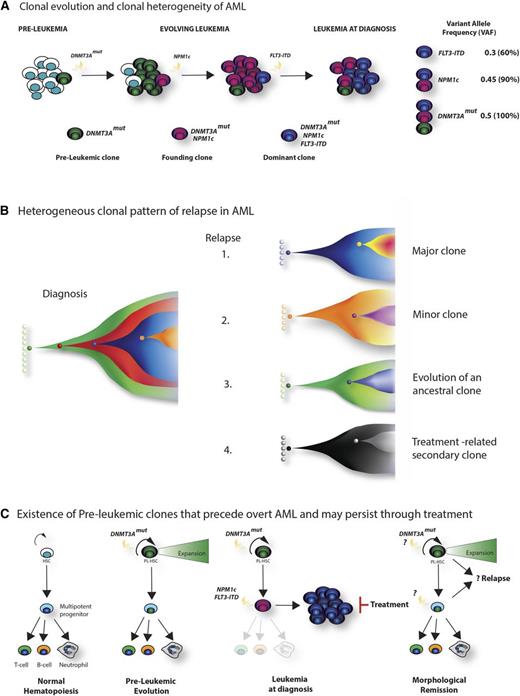 Figure 3. Clonal architecture, patterns of relapse, and the existence of preleukemic stem cells. (A) Clonal evolution and clonal heterogeneity of AML. Evolution of AML in a hypothetical patient whose tumor carries cooperating DNMT3A, NPM1c, and FLT3-ITD mutations. Mutation of DNMT3A is the earliest event, and although facilitating clonal expansion, occurs prior to overt disease development. Subsequently, NPM1c occurs as the disease-defining mutation in the founding clone, with further acquisition of a FLT3-ITD mutation in a hyperproliferative clone during leukemia expansion, which becomes dominant at diagnosis. Quantification of the variant allele frequency (VAF) of each mutation (by VAF, right) allows a demonstration of the temporal acquisition of mutations and the clonal hierarchy of the bulk tumor. For simplicity, a linear evolutionary pattern is shown, although commonly branching evolution can be demonstrated. (B) Heterogeneous clonal pattern of relapse in AML. Potential patterns of relapse from the hypothetical tumor in panel A are shown in the Fish plots: 1, relapse of the dominant clone at diagnosis; 2, relapse of a subclone present at diagnosis; 3, relapse from an ancestrally related clone; 4, “apparent relapse,” where the new tumor is not clonally related to the initial leukemia, such as might happen in therapy-related AML. (C) Existence of preleukemic clones that precede overt AML and may persist through treatment. Recently, the existence of preleukemic stem cells has been demonstrated.50-52 These harbor AML-associated mutations such as DNMT3A, TET2, and IDH2 that permit multipotent differentiation, but also facilitate clonal expansion within the stem and progenitor compartment (panel, second right). Upon the acquisition of further mutations (again NPM1c and FLT3-ITD are shown in the third panel), overt disease develops. However, treatment, although successful in eradicating the AML blasts, does not eradicate the preleukemic stem cells. Evidence suggests that these cells form the reservoir for relapse and resistance (left panel), although further study is required to characterize their biology and prognostic significance.