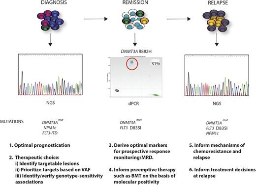 Figure 4. Clinical relevance of the mutational landscape in AML. A longitudinal schematic of various phases of disease are shown for AML. For each time point, possible clinical applications relating to knowledge of the specific mutational complement of the tumor, or the presence of specific mutations, are highlighted. At diagnosis, where in this example DNMT3A, NPM1c, and FLT3-ITD mutations drive disease, WES or panel-based next-generation sequencing (NGS) analysis could optimize prognostication and therapeutic choice, identifying mutations with an existing therapy. Moreover, quantitation of mutation frequency by the VAF could prioritize mutations that exist within every cell as critical targets, and the mutational complement could identify/validate prospective associations between specific mutational genotypes and sensitivity to individual or combined agents. In remission, perhaps using sensitive techniques such as digital polymerase chain reaction (dPCR), identification of the optimal markers for prospective response monitoring could allow early and robust adaptive postinduction therapy such as identifying candidates for stem cell transplant. In the example shown, this would relate to persistence of the DNMT3A mutation, as illustrated by dPCR and the occurrence of an occult FLT3 resistance mutation D835I (yellow clone). At clinical relapse, further WES or panel-based analysis may inform potential mechanisms of chemoresistance and relapse (FLT3 mutation) and in doing so may inform treatment decisions for reinduction and/or further therapy. In this example, the patient has relapsed with a FLT3 mutation (D835I) that would confer therapeutic resistance to some but not all FLT3 inhibitors. The patient has also developed a further subclonal NPM1c mutation in addition to the DNMT3A and FLT3 mutation (purple clone).