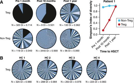 Successful autologous HSCT leads to a renewed and more diverse Treg TCR repertoire. (A) Patient with severe autoimmune disease pre- and postautologous HSCT. The pie charts show TCR β-chain sequencing results in Treg and non-Treg cells collected from a patient with severe autoimmune disease before and after autologous HSCT. N represents the number of different TCR sequences per sample and Di indicates diversity (0 = no diversity, 1 = maximal diversity). Changes in Di before and after HSCT are also shown in the graph. (B) Four healthy controls (HC). For comparison, TCR β-chain sequencing results in Treg cells from 4 HCs are shown in a similar fashion. The figure has been adapted from Figure 4 in the article by Delemarre et al that begins on page 91. Professional illustration by Patrick Lane, ScEYEnce Studios.