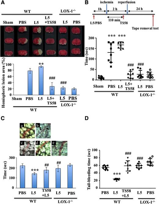 Figure 2. Levels of L5 and LOX-1, L5’s receptor, regulate infarct volume after ischemic stroke in mice. (A) Representative TTC stains of a coronal section of brain tissue for 1 mouse per group at 24 hours after focal cerebral ischemia (top) and the quantification of corresponding brain infarct volumes (bottom) in WT mice treated with PBS, L5 (5 mg/kg), or L1 (5 mg/kg) for 60 minutes before MCAO in addition to TS58 (1 mg/kg, a LOX-1 neutralizing antibody) 110 minutes after MCAO, or in LOX-1−/− mice treated with L5 or PBS. Data are presented as the mean ± SD (n = 8). **P < .01 vs PBS control; ###P < .001 vs L5-treated WT mice. (B) TS58 treatment improved performance in the tape removal test after ischemic stroke. The time needed to remove tape from both the contralateral and ipsilateral paws was recorded for sham-operated mice, WT mice that were treated either with PBS or L5 for 60 minutes before undergoing MCAO and reperfusion, and WT mice treated with L5 (5 mg/kg) for 60 minutes before MCAO and then treated with TS58 (1 mg/kg) 10 minutes before reperfusion. Data are presented as the mean ± SD (n = 8). ***P < .001 vs sham control; ###P < .001 vs L5-treated WT mice. (C) LOX-1 neutralizing antibody inhibits the L5-induced shortening of occlusion times for inducing thrombus formation in mesenteric venules of mice. Mice (WT and LOX-1−/−) were administered isovolumetric PBS solution, L5 (5 mg/kg), or TS58 (1 mg/kg) + L5 (5 mg/kg), and then mesenteric venules were selected for irradiation to induce microthrombus formation. (a) WT mice treated with PBS; (b) WT mice treated with L5; (c) WT mice treated with TS58 and L5; (d) LOX-1−/− mice treated with L5; (e) LOX-1−/− mice treated with PBS. Microscopic images (×400) obtained during the 143-second time period after the injection of fluorescent sodium (15 μg/kg) and transillumination in mice treated with PBS, L5 (5 mg/kg), or TS58 (1 mg/kg) + L5 (5 mg/kg). Arrows indicate platelet plug formation. Photographs are representative of 8 similar experiments. Bar, 30 μm. Data in the bar graph are presented as the mean ± SD (n = 8). ***P < .001 vs PBS control; ##P < .01 vs L5-treated WT mice. (D) TS58 treatment prolongs tail-bleeding time in L5-treated mice. Tail-bleeding time was determined after treatment with PBS or L5 (5 mg/kg) in LOX-1−/− mice and after treatment with PBS, L5 (5 mg/kg), or TS58 (1 mg/kg) + L5 (5 mg/kg) in WT mice. Data represent the time from tail amputation to the time of blood flow cessation for longer than 10 seconds. Data are presented as the mean ± SD (n = 12). ***P < .001 vs PBS-treated WT mice; ###P < .001 vs L5-treated WT mice.