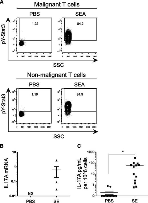 Figure 4. SE treatment leads to STAT3 phosphorylation and subsequent IL-17 secretion in primary T cells from CTCL patients. (A) Representative flow cytometric analysis of PBMCs freshly purified from a CTCL patient and cultured for 24 hours with SEA (200 ng/mL) or vehicle (PBS). After incubation, cells were stained for pY-STAT3 and CD3, CD4, and CD26. Nonmalignant T cells stain CD3+, CD4+, and CD26+, whereas malignant T cells stain CD3+, CD4+, and CD26−. (B) PBMCs from CTCL patients were stimulated with an SE cocktail of SEA, SEB, SEC2, SEE, SEI, and TSST-1 (200 ng/mL) or vehicle (PBS) for 24 hours. After incubation, IL17A expression and GAPDH expression were determined by qPCR. In each sample, IL17A expression is normalized to GAPDH. (C) Pooled data of PBMCs from CTCL patients stimulated for 24 hours with an SE cocktail of SEA, SEB, SEC2, SEE, SEI, and TSST-1 (200 ng/mL) or vehicle (PBS). IL-17A concentrations were determined by ELISA and normalized to 106 cells. *P < .05. ND, not detected.