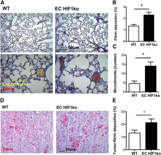 Figure 5. Cancer-associated thrombosis is enhanced in the pulmonary microvasculature and pulmonary tumors of endothelial HIF1α knockout mice. (A) Tumor-bearing lung cross-sections of wild-type (WT) and endothelial HIF1α knockout (EC HIF1ko) mice stained with Martius Scarlet Blue for fibrin (red) and erythrocytes (yellow). (B) Quantification of fibrin deposition and (C) microthrombi number in pulmonary microvasculature of tumor-bearing WT and EC HIF1ko mice (n = 5/group). (D) Pulmonary tumors of WT and EC HIF1ko mice stained with Martius Scarlet Blue. (E) Quantification of tumor fibrin deposition in WT and EC HIF1ko mice (n = 5/group). Images are of representative tissue cross-sections. *P < .05.