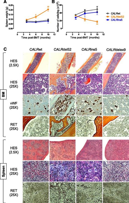 Figure 2. BM and spleen features show evolution of the disease to myelofibrosis for all CALRdel52 mice and 1 CALRins5 mouse. (A) Spleen weight and (B) BM cellularity (n = 3-5), expressed as mean ± SEM. Student t test: *P < .05, **P < .001. (C) Hematoxylin-eosin-safran (HES), von Willebrand factor staining (vWF) and reticulin silver stain (RET) of 10-month-old mouse BM and spleen of CALRdel52 mice show clusters of MKs, osteosclerosis, and a progressive thickening of the reticulin network. Images were obtained using a DM2000 Leica microscope and a DFC300FX Leica camera with Leica Application Suite, v.2.5, OR1 acquisition software (×2.5 and ×25 magnifications).