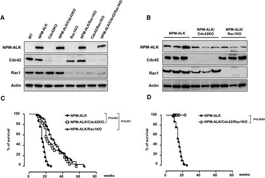 Figure 1. Deletion of Cdc42 or Rac1 impair NPM-ALK lymphoma development in vivo. (A) Representative western blots of Cdc42 and Rac1 deletion in pretumoral thymuses obtained from wild-type (WT) or NPM-ALK transgenic mice. Mice were euthanized at 4 weeks of age when lymphoma was not phenotypically and morphologically detectable as previously described.12 Cell lysates were extracted and membranes were blotted with the indicated antibodies. (B) Representative western blots for Cdc42 and Rac1 deletion in primary tumors from mice with the indicated genotype. Three tumors out of 10 analyzed for each genotype are shown. (C-D) Kaplan-Meier survival curves of NPM-ALK transgenic mice in the presence or absence of Cdc42 and/or Rac1. NPM-ALK mice were crossed with mice carrying the indicated conditional knocked-in alleles. All mice were analyzed by necropsy to demonstrate the presence of lymphoma: NPM-ALK (n = 70), NPM-ALK;CD4Cre;Cdc42fl/fl (NPM-ALK/Cdc42KO; n = 25), NPM-ALK;CD4Cre;Rac1fl/fl (NPM-ALK/Rac1KO; n = 58), and NPM-ALK;CD4Cre;Cdc42fl/fl;Rac1fl/fl (NPM-ALK/Cdc42/Rac1KO; n = 17).